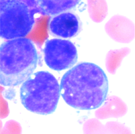 Immature Monocytes